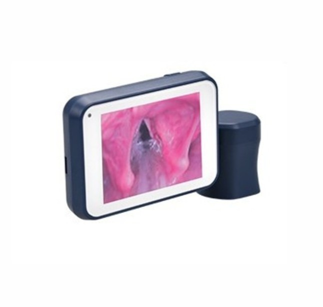 20260721-1609-12913-Monitor-com-Tela-LCD-do-Video-Laringoscopio-Marca-Besdata5674.jpg